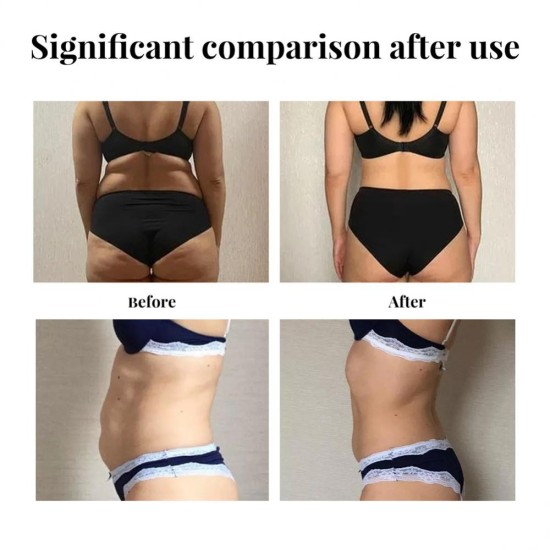 Mymi Wonder Slimming Patch